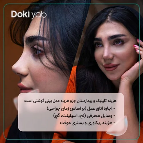 تاثیر هزینه بیمارستان بر هزینه عمل دماغ گوشتی؛ نمونه کار عمل بینی در دکی یاب
