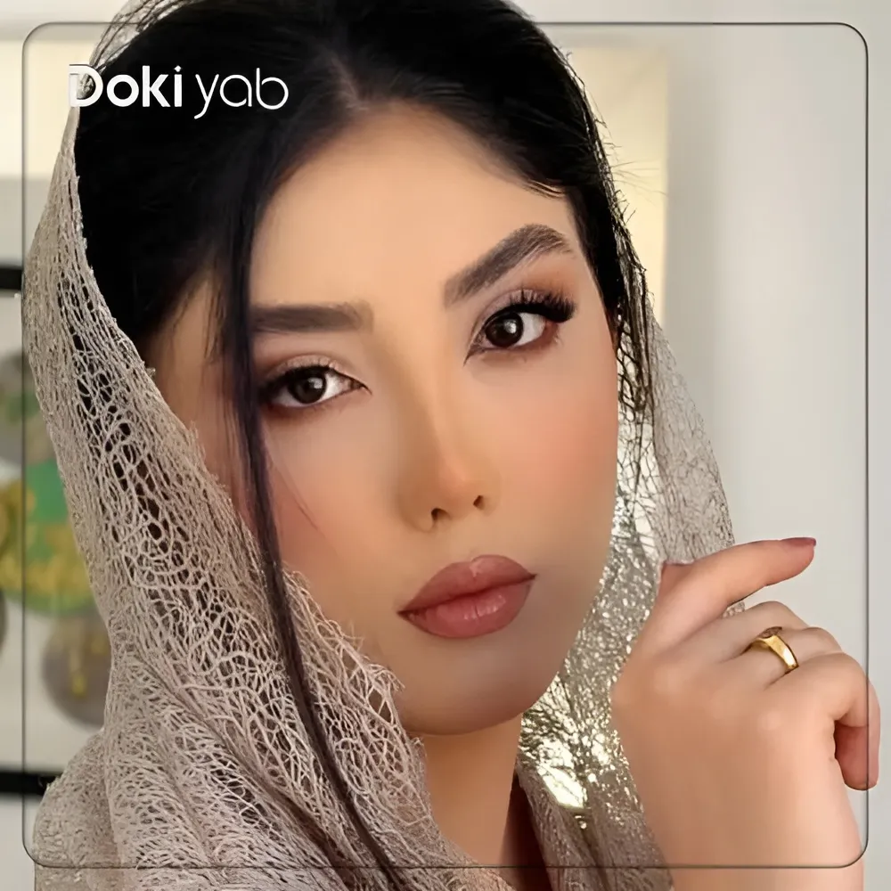 نتیجه جراحی بینی زنانه توسط دکتر محمودرضا اصحاب یمین در تصویر نمونه کار
