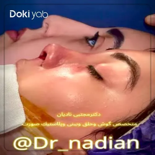 مقایسه فرم بینی قبل و بعد از عمل دماغ توسط دکتر مجتبی نادیان